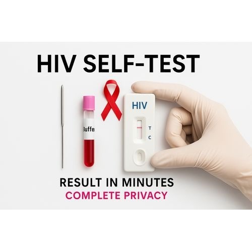 تحليل اختبار HIV - الايدز