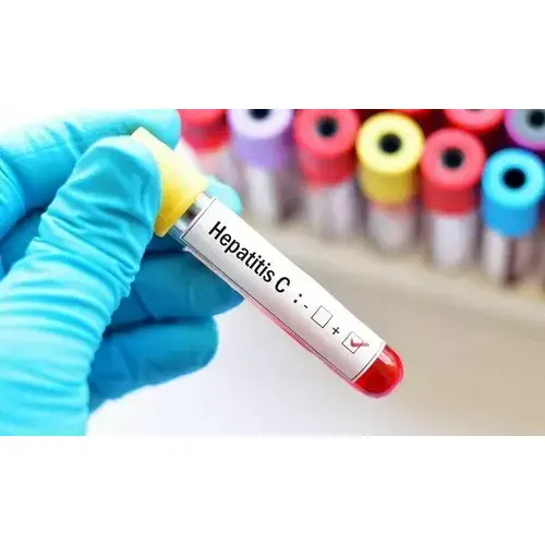 تحليل HCV السريع للكشف المنزلي عن التهاب الكبد C بدقة عالية