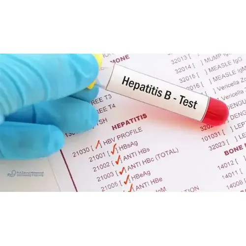 تحليل HBV الدقيق للكشف السريع عن التهاب الكبد B